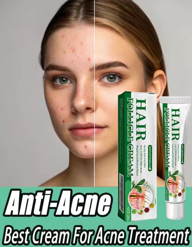 crème Anti-acné efficace élimine les Nodules de la peau Pustules Cysts Papules points noirs hommes et femmes acné soin de la peau crème Essence